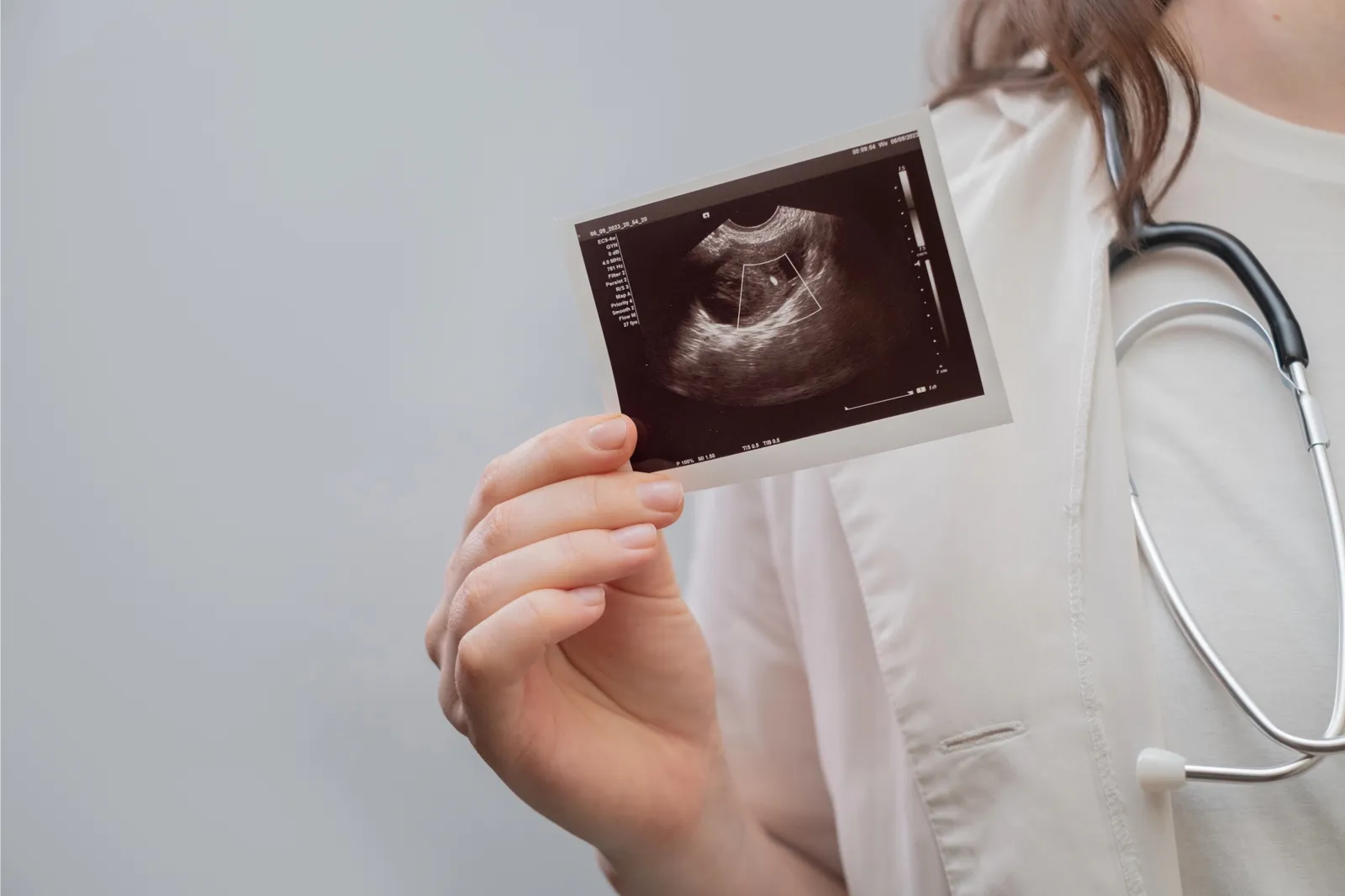 Abortion Restriction and Surrogacy in America Post-Dobbs
